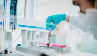 ¿Cuánto tiempo sobrevive el Coronavirus COVID-19 en distintas superficies?