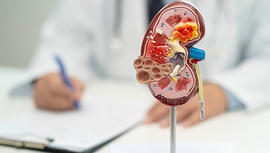 FUNDAMENTOS DE LA ENFERMEDAD RENAL CRÓNICA Y ATENCIÓN INTEGRAL