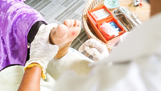 CUIDADOS DEL PIE DIABÉTICO